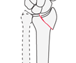 distal forearm