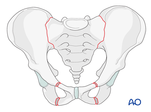 pubic-ramus-fractures