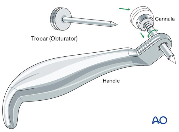 Transbucall handle and trochar