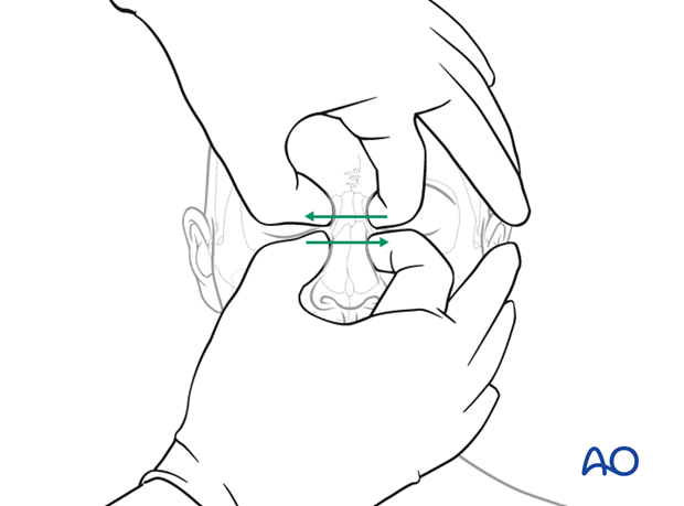 examination of patients with midfacial injuries